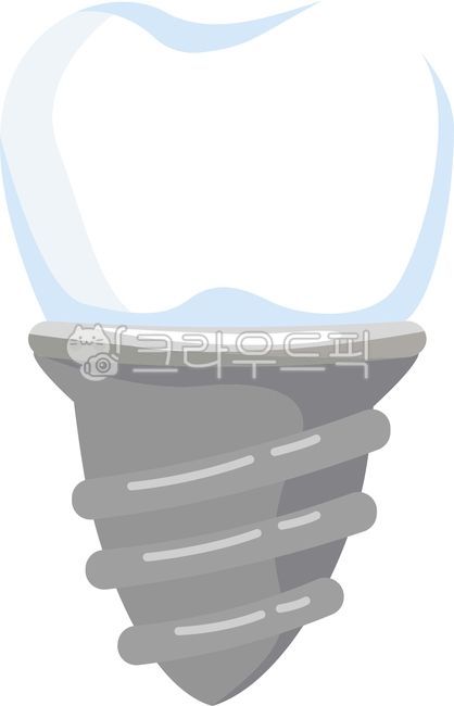 Implants,dentistry,molars,teeth,teeth,cavities,orthodontics,dentures,dental treatment