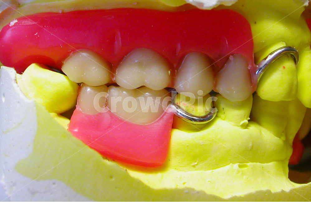 치과,의료,틀니,틀니제작,denture,성형,보험,노인,치과기공,이빨,치아,기공사,치과기공사,의료보험,보철,의치,교합,의료,의학,병원,medical,hospital,clinic,사물,물건,오브젝트,thing,object,matter