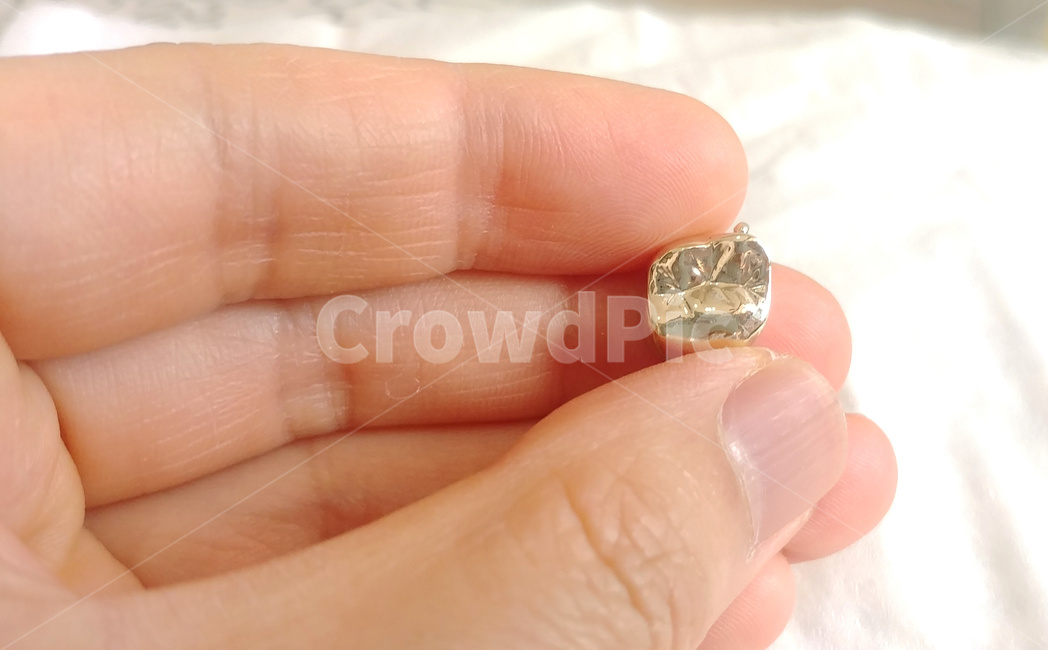 치과,덴탈,크라운,보철,골드크라운,crown,치과기공사,손,dental