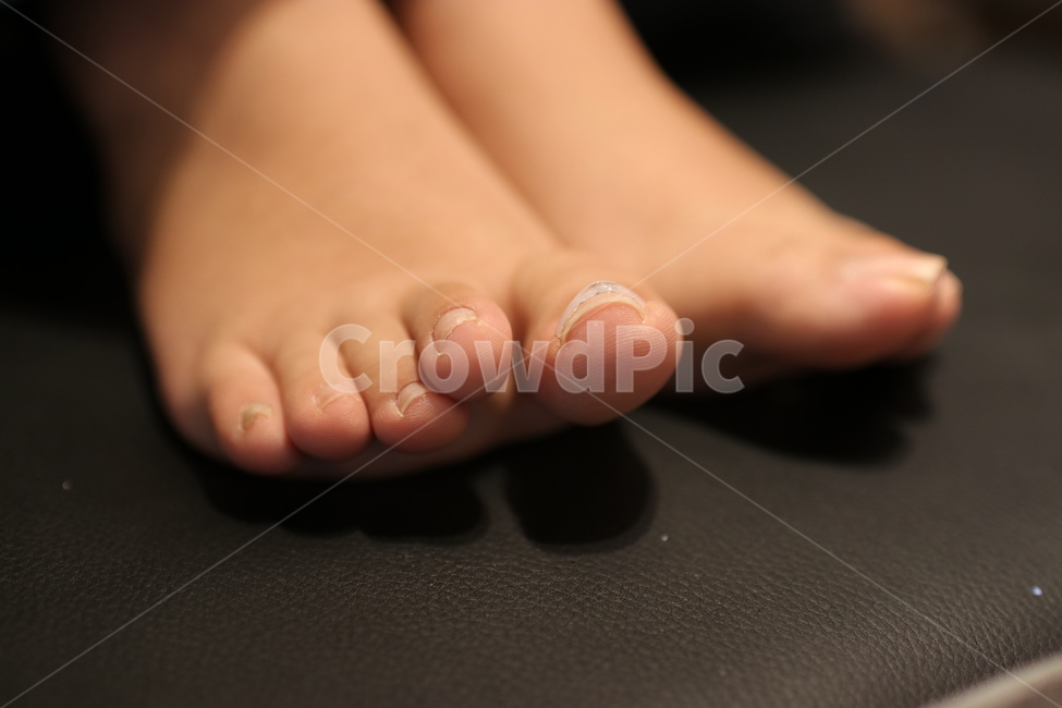 발톱,파고드는발톱,발톱교정,교정기,교정,발톱관리,패디,패디큐어,발,발가락,발끝,사람,인물,인간,human,person,신체일부,몸,body