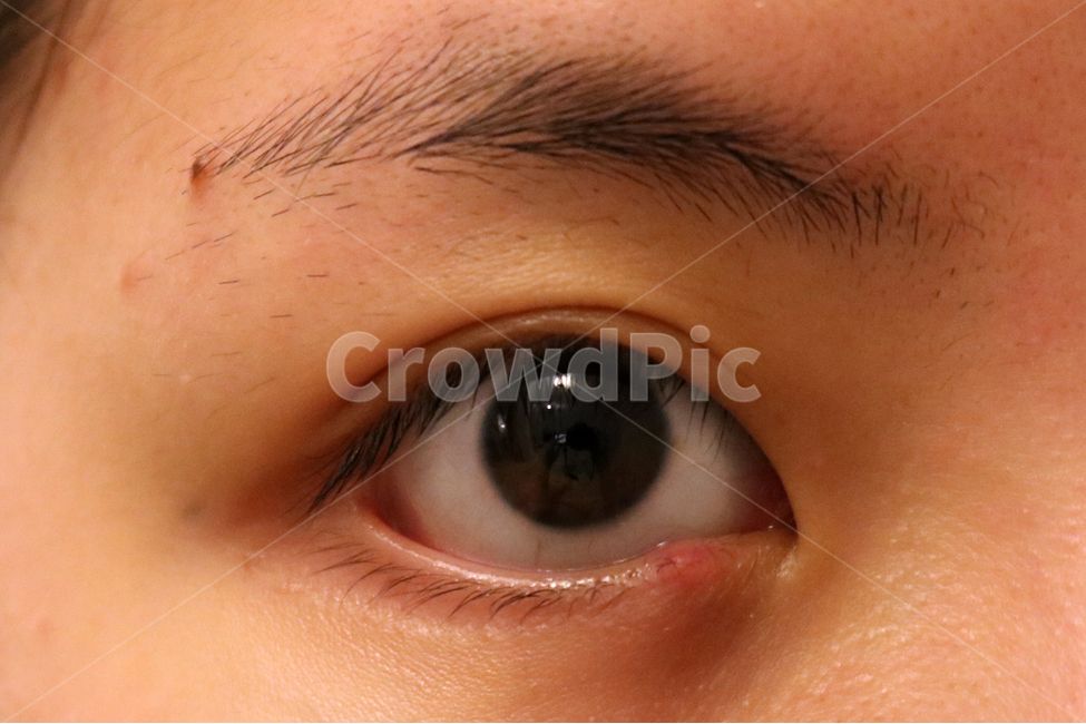 다래끼,눈,눈빛,eye,stye,hordeolum,정면을보는눈,삼백안,쌍꺼풀,쌍커풀있는눈,미세먼지,사람,인물,인간,human,person,신체일부,몸,body,의료,의학,병원,medical,hospital,clinic