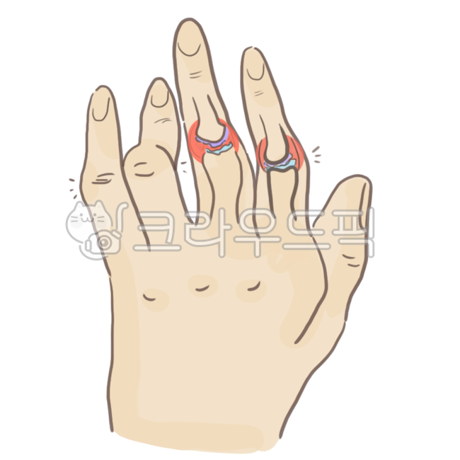 rheumarthritis,류마티스,손가락관절염,병원,수부,류마티스관절염,hospital,rheumaticgout,finger,신체부위,손가락,손가락마디,손마디,손마디통증,통증,정형외과