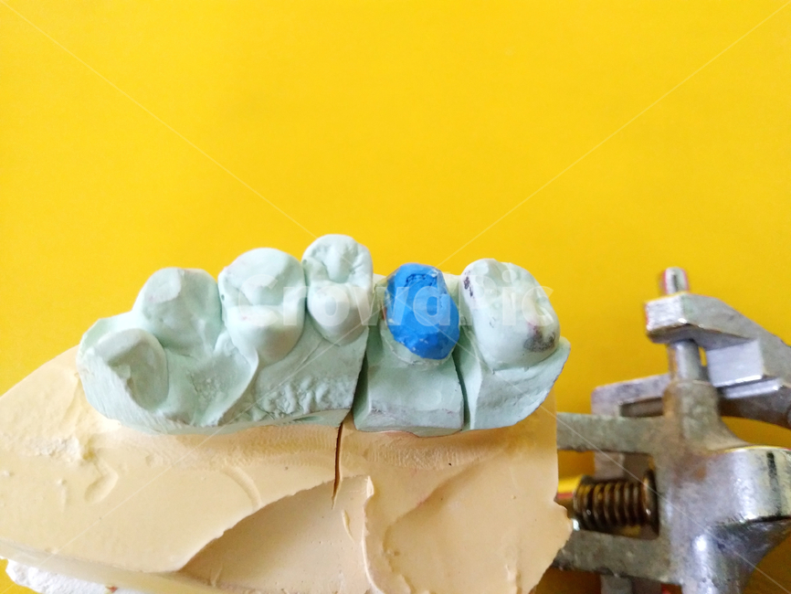 치아,치아모형,석고,모형,치과,치과치료,구강위생,healthcare,치과의원,dental,clinic,teeth,model,치과의사,dentist,병원,의료,의학,병원,medical,hospital,clinic