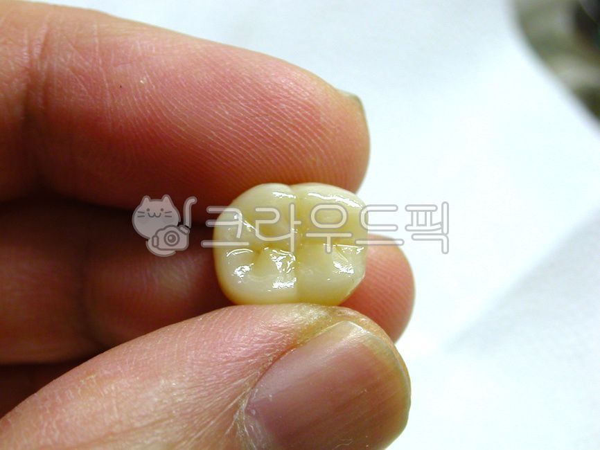 ceramic,dental,Dentist,prosthetics,molars,dental technician,zirconia,molar