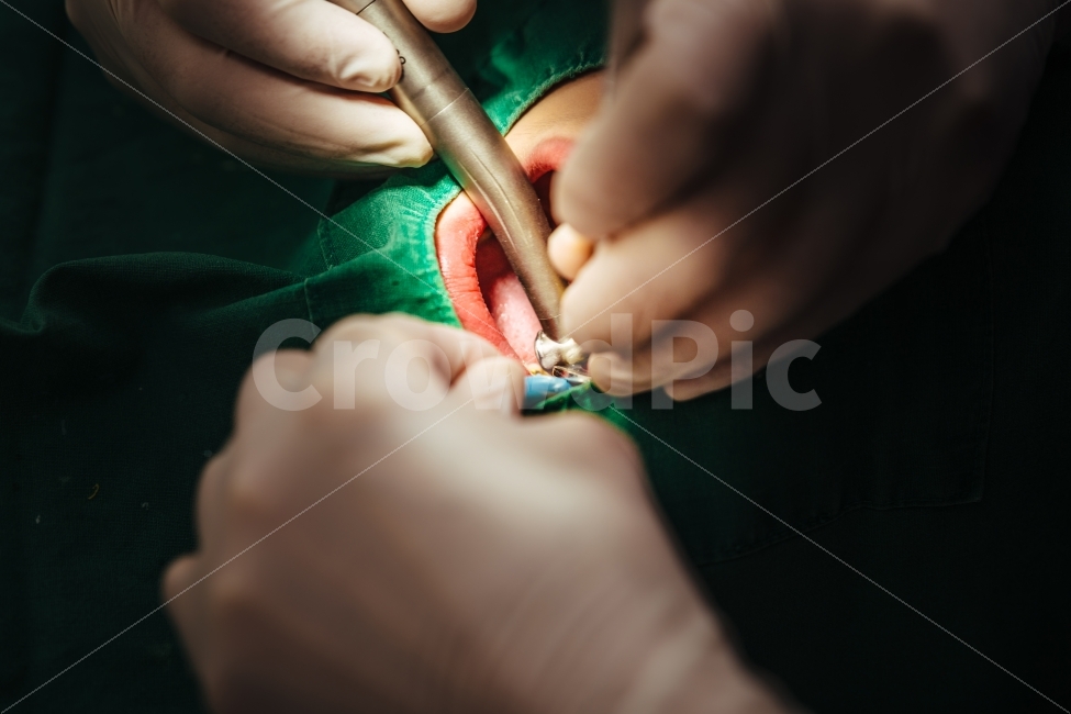 치과,의사,환자,치료,보험,구강,충치,건강,치통,치아,검진,아말감,레진,클리닉,의료,의료,의학,병원,medical,hospital,clinic