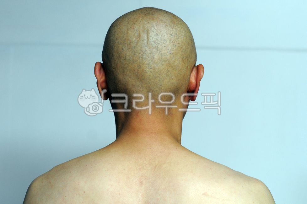 머리,대머리,뒷모습,삭발,등,흰배경,head,baldhead,back,white,whitebackground,배경,skin,피부
