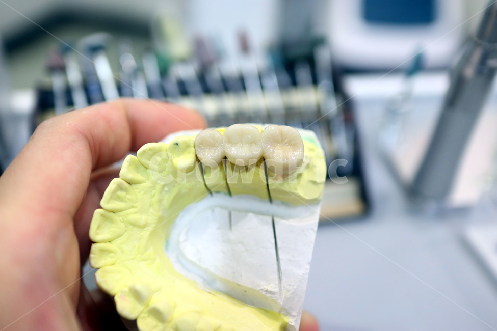 치과,보철,지르코니아,zirconia,이빨,덴탈,치아,의료,보험,의료,의학,병원,medical,hospital,clinic