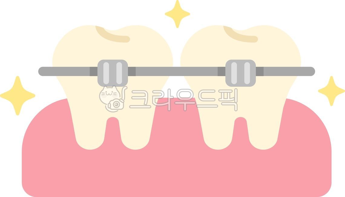 Correction,orthodontics,teeth,teeth,orthodontics,dentistry,dental orthodontics,orthodontic dentistry,orthodontic teeth,orthodontics illustration,orthodontics illustration,teeth illustration,this,hospital,dental treatment,dental treatment,d