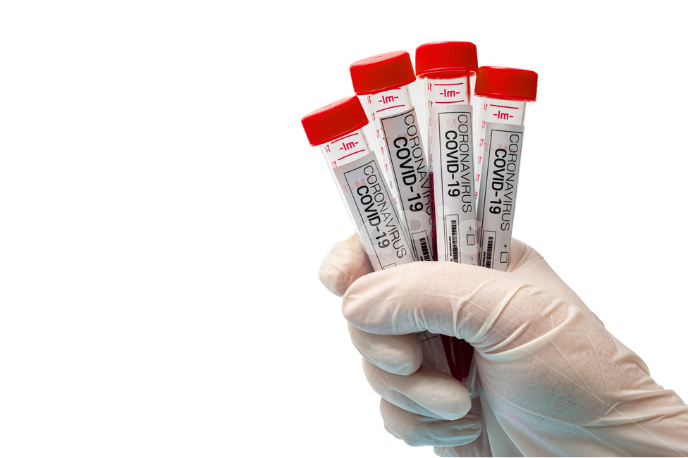 medical,covid,diagnostic kit,Science,rapid,white background,virus,latex,red,gloves,supplies,kit,examination,corona,gene amplification,disease,test,coronavirus,diagnosis,equipment,medicine,analysis,blood,covid19,tube,vaccine,laboratory,infectious disease,b