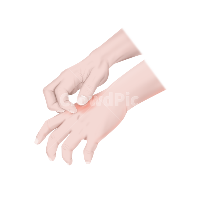 메디컬,medical,png,일러스트,메디컬일러스트,피부,질환,가려움증,병증,증상,누끼,remove background