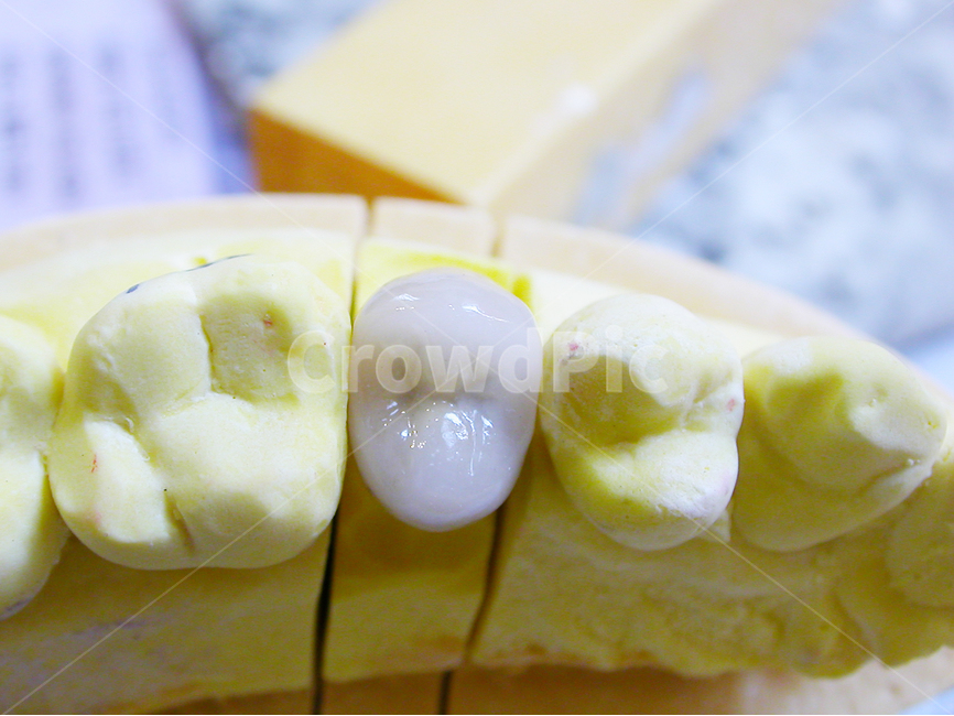 치과,의료,치아,치과기공사,보철,소구치,도자기치아,이빨,덴탈,dental,의료,의학,병원,medical,hospital,clinic,사물,물건,오브젝트,thing,object,matter