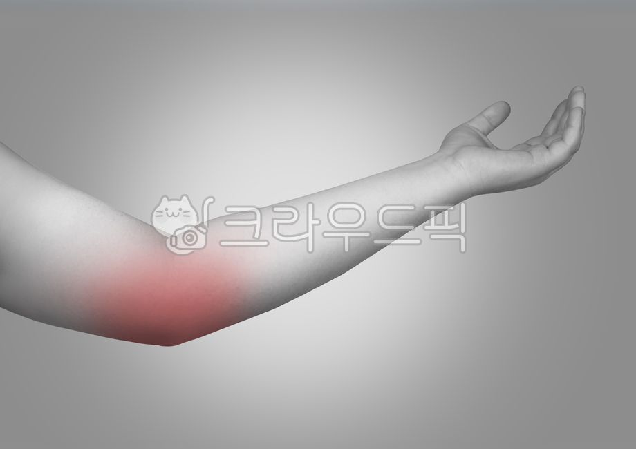 Arm,Golfer's Elbow,Elbow Pain,Arm Pain,Elbow,Inner Arm,Medial Epicondylitis