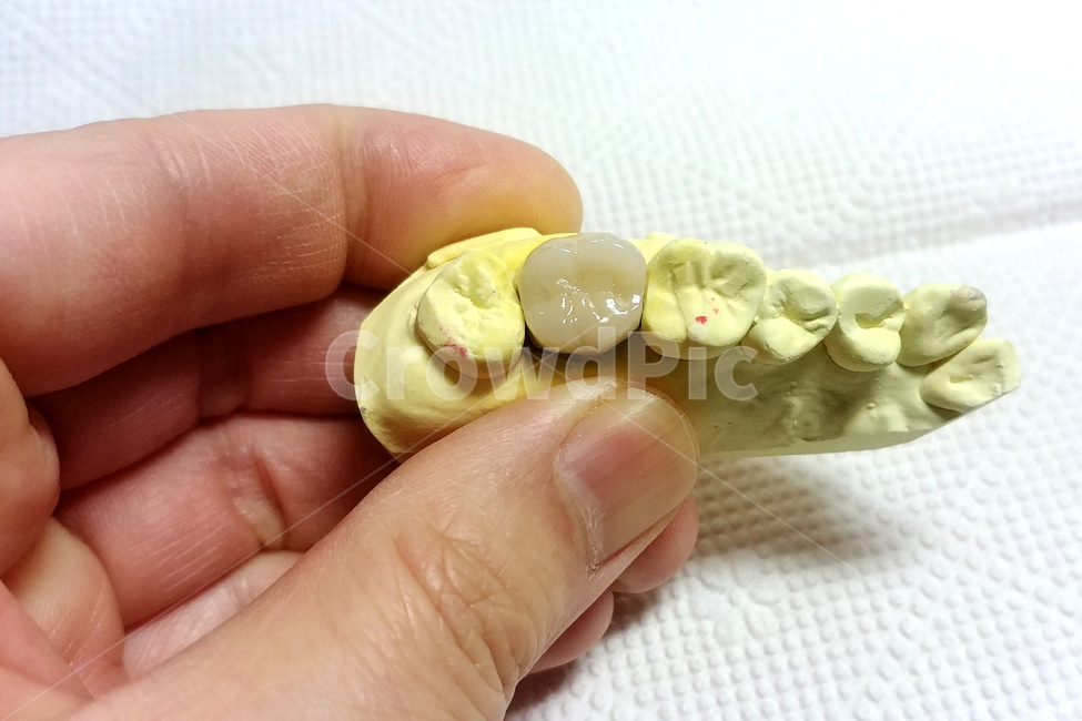 치과,보철,치아,덴탈,어금니,치과기공사,손,인공치아,dental,석고,의료,의학,병원,medical,hospital,clinic