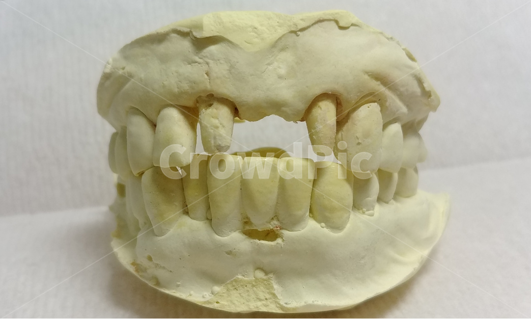 치과,치아모형,석고,이빨,치아,teeth,이,모형,의학,덴탈,dental,dentist,의료,의학,병원,medical,hospital,clinic