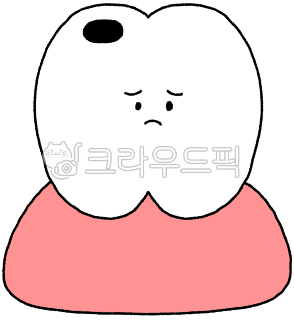 Cavities,cavity pictures,cavity drawing,cavity illustration,teeth,teeth pictures,teeth drawing,teeth illustration,dentistry,dentistry pictures,dentistry drawing,dentistry illustration,dental treatment,dental treatment pictures,gum health,gu