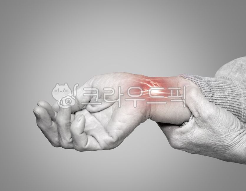 Carpal tunnel syndrome,wrist,wrist pain,hand pain,arm pain,wrist disease,orthopedics