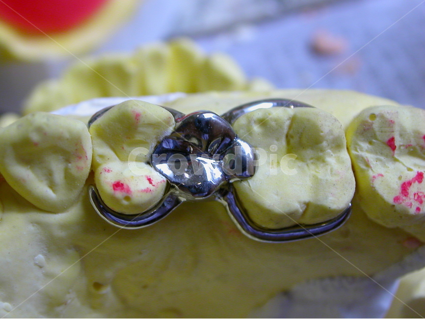 치과,틀니,보철,의료,denture,보험,치과기공,이빨,치아,의료,의학,병원,medical,hospital,clinic,사물,물건,오브젝트,thing,object,matter