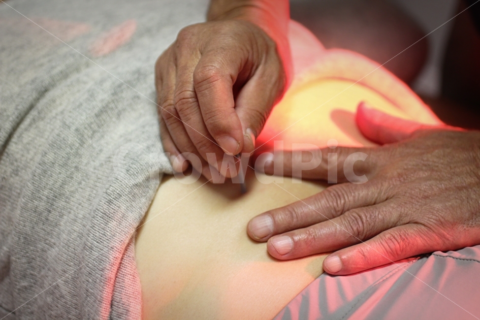 병원,침,한의원,한의사,손,환자,한방의학,사람,연출,마네킹,인체모형,침술,Acupuncture,Hospital,Mannequin,Nobody,한국전통,한국문화,korean traditional,korean culture,사람,인물,인간,human,person,신체일부,몸,body,손,제스처,표시,손짓,표현,gesture,hand,sign,expression,의료,의학,병원,medical,hospital,clinic,연출,컨셉,콘셉,direction,concept