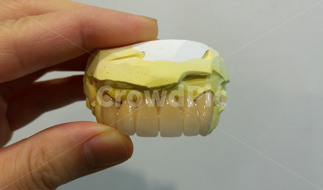 치과,보철,지르코니아,치아,덴탈,이빨,zirconia,dental,인공치아,의료,의학,병원,medical,hospital,clinic