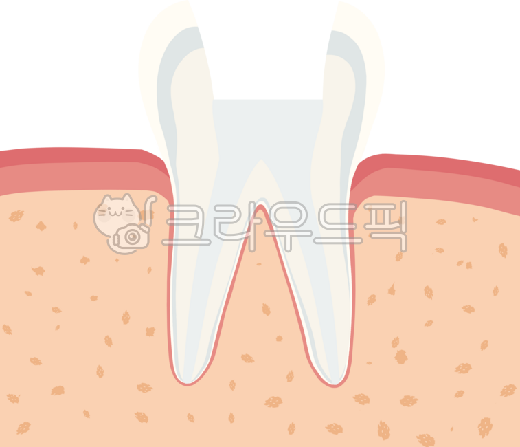 어금니,충치,신경치료,치아,치과,염증,크라운,인레이,레진,치경부,마모,잇몸,치주