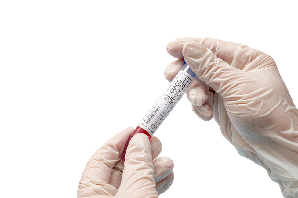 medical,covid,diagnostic kit,Science,rapid,white background,virus,latex,red,gloves,supplies,kit,examination,corona,gene amplification,disease,test,coronavirus,diagnosis,equipment,medicine,analysis,blood,covid19,tube,vaccine,laboratory,infectious disease,b