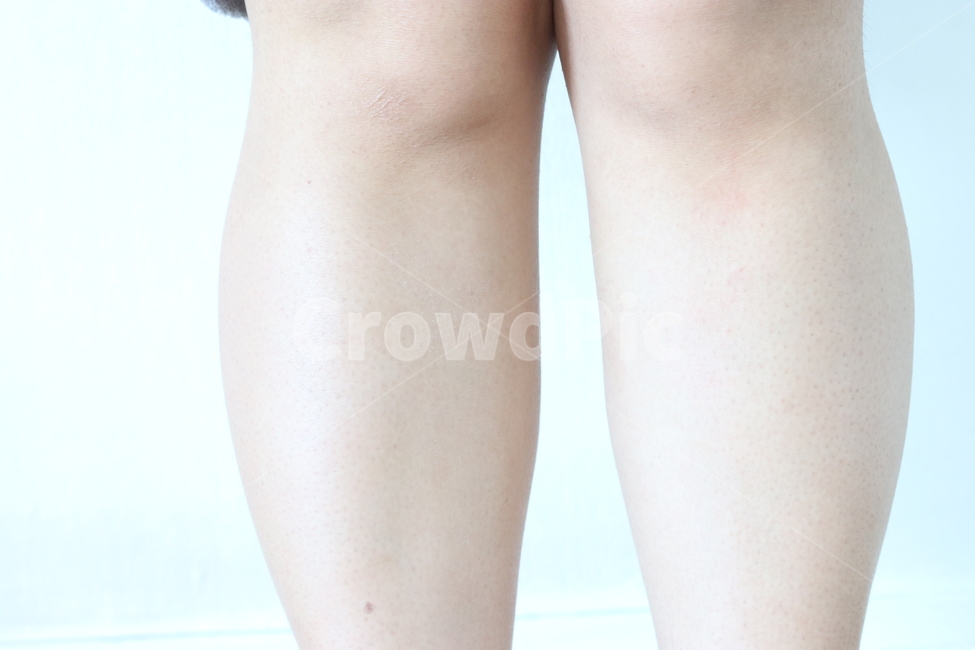 스크럽,각질제거,닭살,각질,피부,skin,다리,무릎,종아리,사람,인물,인간,human,person,신체일부,몸,body