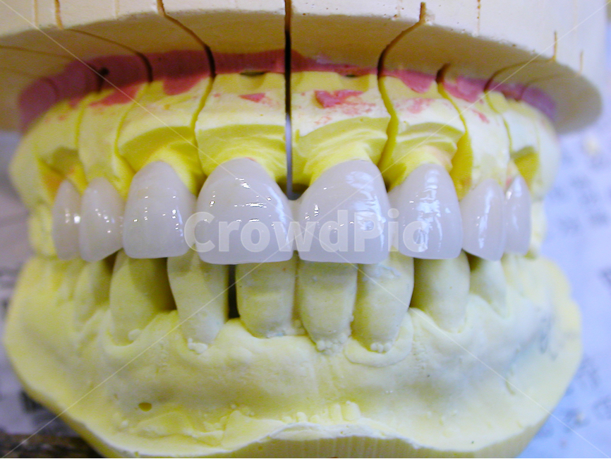 치과,의료,치과기공사,앞니,포세라인,porcelain,기공,덴탈,치아,이빨,tooth,전치,도자기,도자기치아,의료,의학,병원,medical,hospital,clinic,사물,물건,오브젝트,thing,object,matter