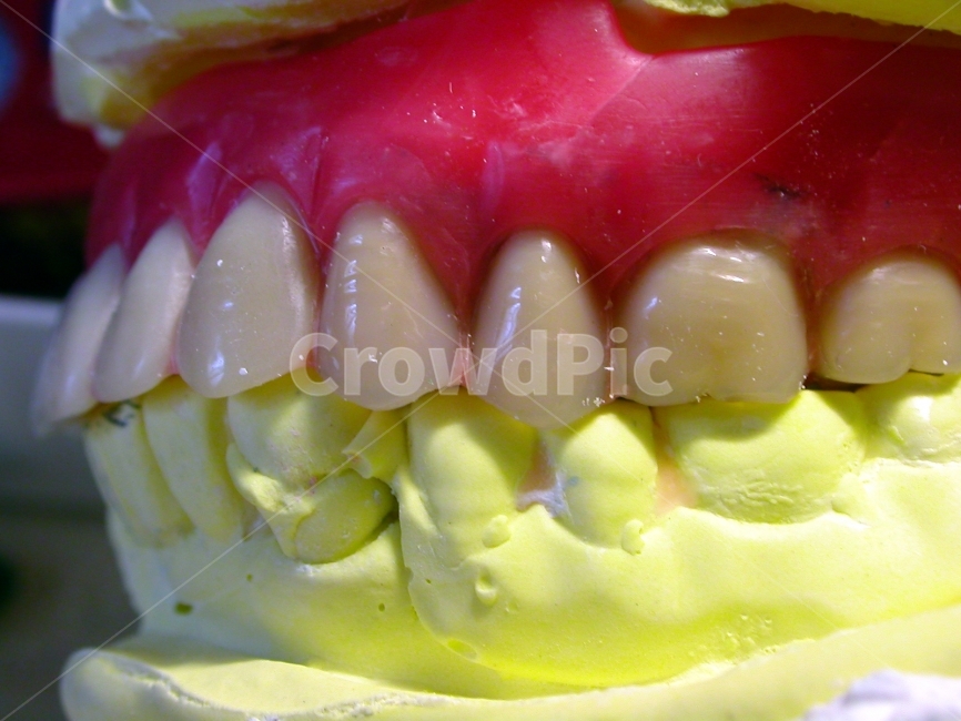 치과,치아,성형,틀니,의학,이빨,보철,덴쳐,치과기공,denture,의사,치과의사,보험,치료,직업,덴탈,dental,의치,교합,의료,의학,병원,medical,hospital,clinic,사물,물건,오브젝트,thing,object,matter