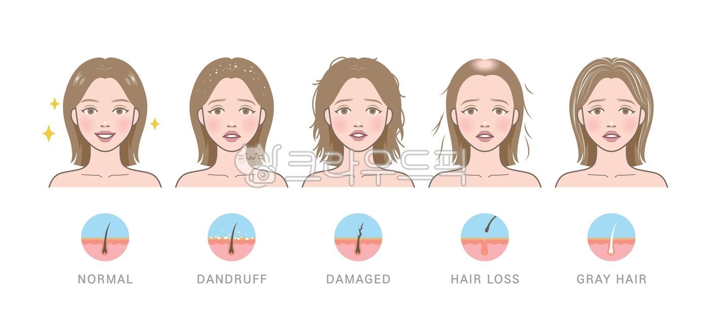 Head,hair,hair texture,hair loss,baldness,alopecia areata,hair loss,voluminous,thick,hair volume,volume,gray hair,gray hair,aging,volume,problem,damaged,damaged hair,split,split,fluffy,dull,dandruff,dead skin cells,woman,female,p