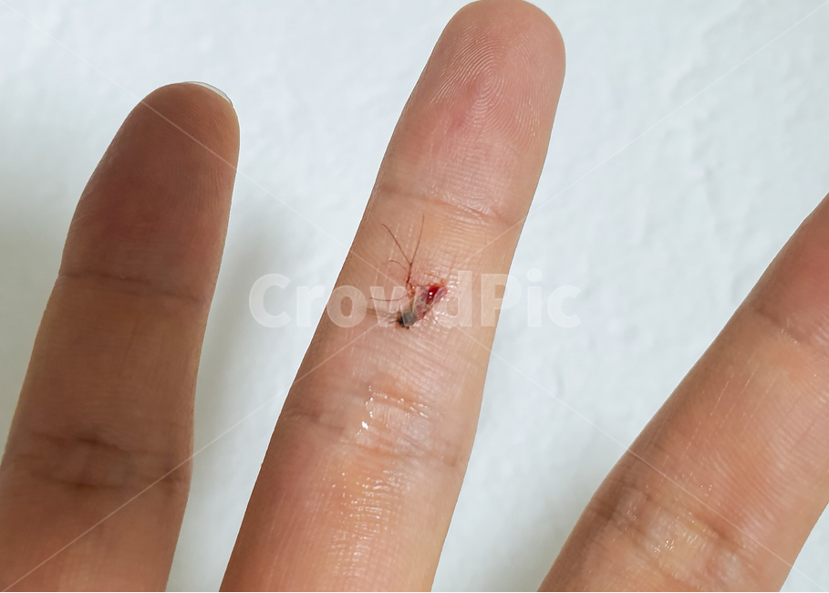 모기,가을모기,해충,손가락,피,흡혈,벌레,곤충,손,여름,살충,곤충,벌레,insect,bug,신체일부,몸,body
