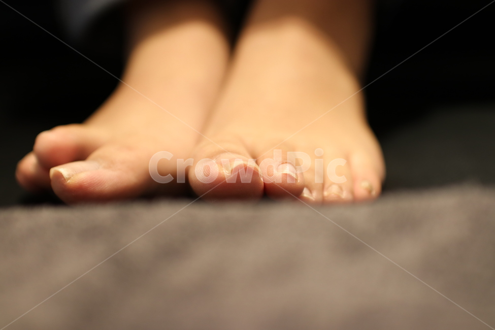 발톱,파고드는발톱,발톱교정,교정기,교정,발톱관리,패디,패디큐어,발,발가락,발끝