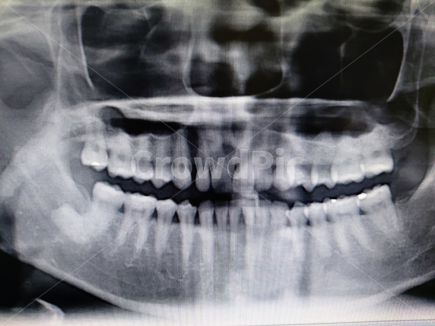 medicalimagingxrayfilm,의료영상x선필름,ctscan,xray,엑스레이,치과,의료,의학,병원,medical,hospital,clinic