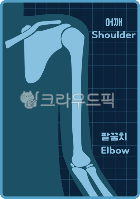 X-ray,X-ray drawing,bone,human bone,human body,X-ray illustration,human body illustration,bone illustration,hospital play drawing,teaching aid drawing,teaching aid,play drawing,play,play aid,hospital play,shoulder blade,shoulder,elbow,sh