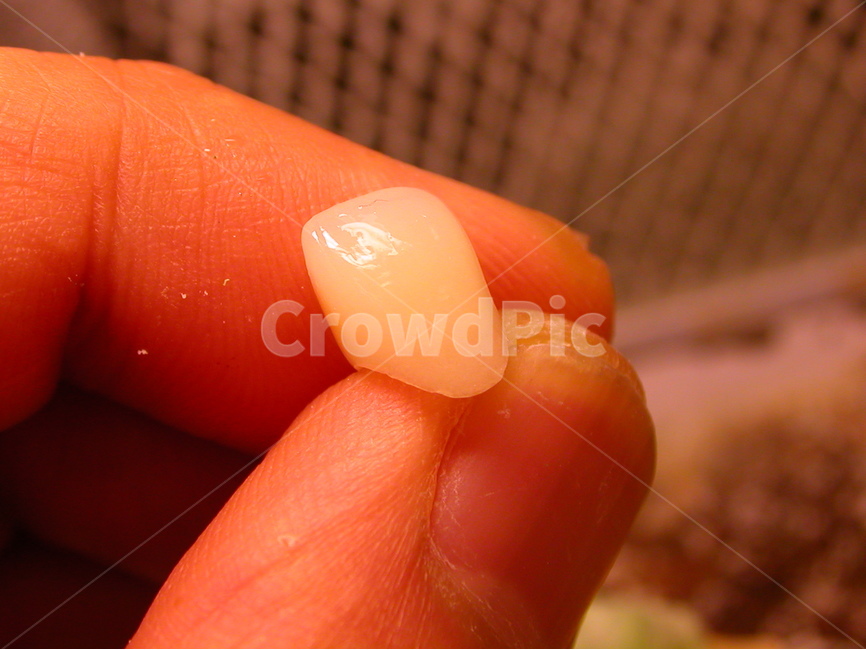 치과,의료,치아,이빨,치과기공,앞니,성형,입,지르코니아,zirconia,보철,덴탈,dental,의료,의학,병원,medical,hospital,clinic
