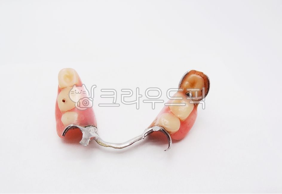 틀니,부분틀니,치과,보철,의치,국소의치,하악,금속,레진,치아,클래스프,낡은,부러진,틀니수리,구강보건,구강위생,의료,보건,치료,진료,노인환자,환자,의료보험,보험틀니,국민건강보험,치과기공,치과의원,치과병원,치과재료,치과의사,denture,dentistry,dental,teeth,resin,clasp,metal,prosthetics,의료,의학,병원,medical,hospital,clinic