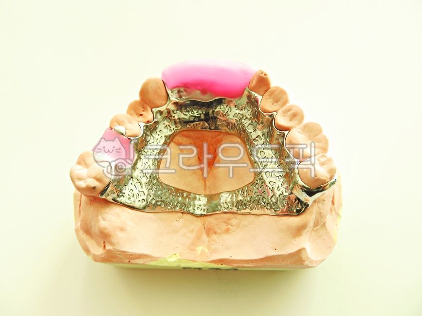 치과,틀니,보철,의료보험,의료,보건,부분틀니,의치,국소의치,치과기공,치과의사,치과의원,치과병원,병원,치료,진료,치의학,금속,메탈,프레임,보험틀니,건강보험,구강,구강보건,인공적인,컨셉,concept,artificial,prosthetic,medical,dental,care,treatment,dentist