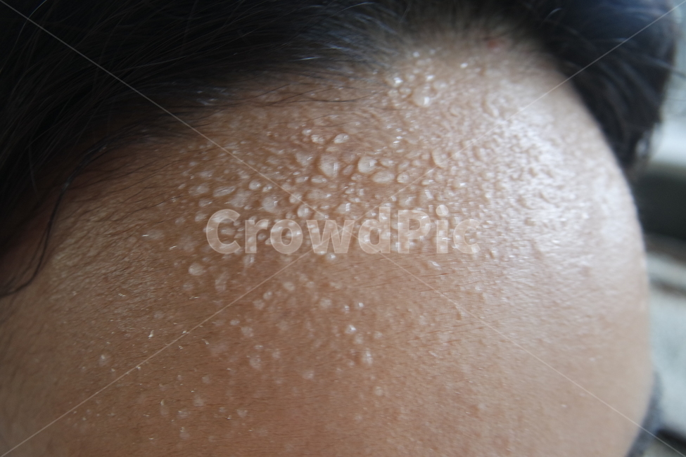 sweat,땀,skin,피부,neck,목,다한증