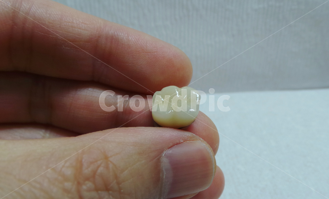 치과,보철,어금니,치과기공사,치아,teeth,보험,porcelain,dental,의료,의학,병원,medical,hospital,clinic
