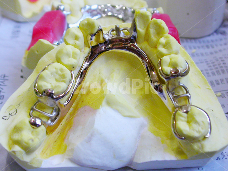 치과,의료,보험,틀니,덴쳐,치과기공사,치기공,치아,이,tooth,보철,의료,의학,병원,medical,hospital,clinic,사물,물건,오브젝트,thing,object,matter