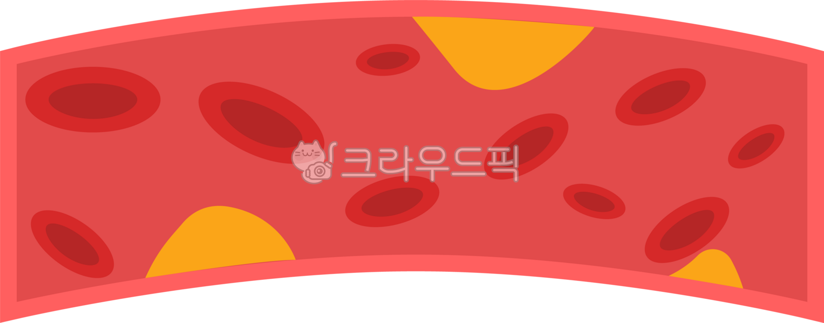 Blood vessels,red blood cells,fat,cholesterol,blood circulation,blood flow,arteries,blood,arteriosclerosis,disease,neurology,cerebral infarction,blood vessel management,blood vessel health,health management