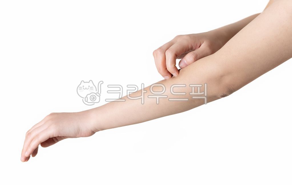 소양증,가려움증,가려운,긁는,간지럼,간지러운,가려움,고통,건조,피부,스킨케어,팔,여자,손,의료뷰티,피부발진,누끼,스튜디오,피부병,관리,pruritus,tickling,pain,dryness,skin,skincare,arm,woman,hand,medicalbeauty,skinrash,lucky,studio,skindisease,body,bite,finger,disease,dry,symptom,isolated,itch,allergic,scratch,atopic,allergy,care,dermatitis,itchy,health,dermatology