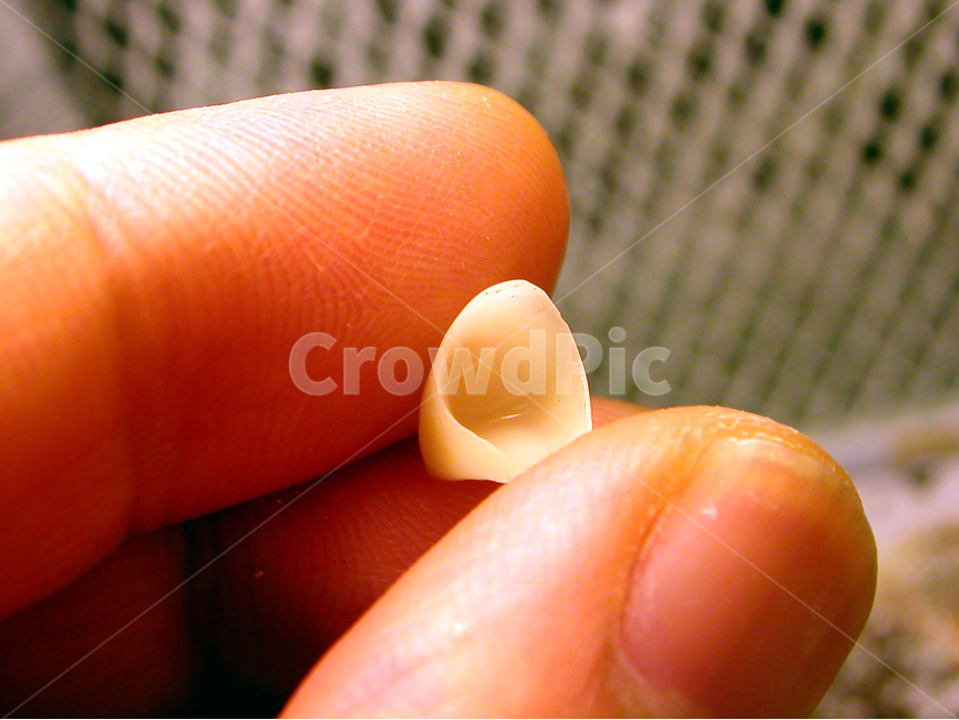 의료,치과,이빨,치아,지르코니아,이,치과기공,앞니,성형,zirconia,보철,덴탈,dental,의료,의학,병원,medical,hospital,clinic
