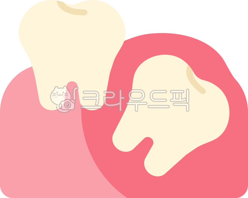 매복사랑니,사랑니,사랑니발치,사랑니추출,사랑니통증,발치,사랑니발진,뒷어금니,어금니,사랑니제거,치과,이빨,치아,이,wisdomtooth,dental,dentist,tooth,teeth,잇몸,치과치료,충치치료