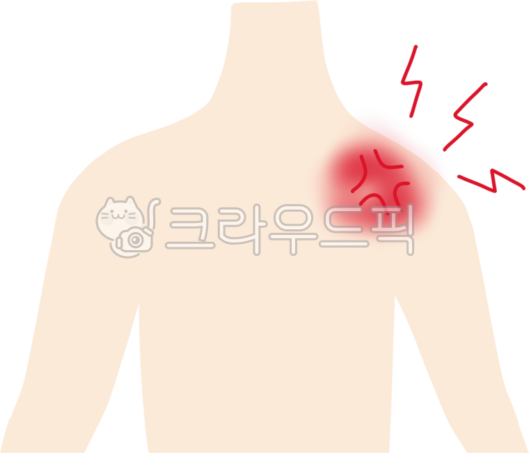 환자,극상근건염,질환,의학,어깨,증상,팔을들지못하는,메디컬,어깨부상,오십견,어깨통증일러,어깨통증종류,어깨통증요소,어깨통증형태,어깨통증모양,어깨통증장식,어깨통증리소스,어깨통증,어깨질환,아픔,통증,쑤심,저림,결림