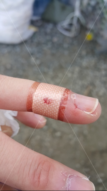 손가락,상처,밴드,피,손톱,휴지,큐티클