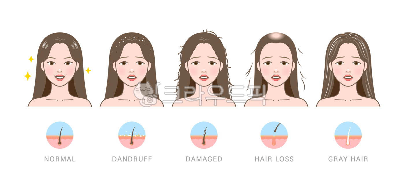 Head,hair,hair texture,hair loss,baldness,alopecia areata,hair loss,voluminous,thick,hair volume,volume,gray hair,gray hair,aging,volume,problem,damaged,damaged hair,split,split,fluffy,dull,dandruff,dead skin cells,woman,female,p