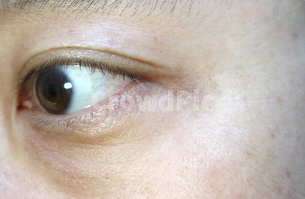 기미,노화,주름살,피부,피부과,skin,사람눈,eye,눈동자,쌍거풀,쌍꺼풀,홍채,속눈썹,사람,인물,인간,human,person,신체일부,몸,body