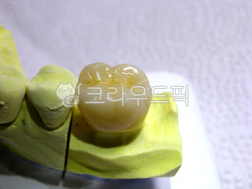 ceramic,dental,Dentist,prosthetics,molars,dental technician,zirconia,molar