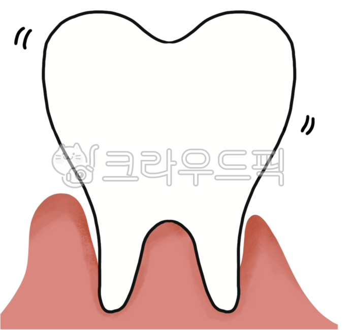 gingivitis,Dentist,Gum illustration,porketdepth,dental disease,periodontal disease,gingiva,teeth,Tooth illustration,tartar,tooth root,dental treatment,Periodontal disease symptoms,gum disease,Subperiodontal,periodontal injury,periddontitis,periodontitis,o