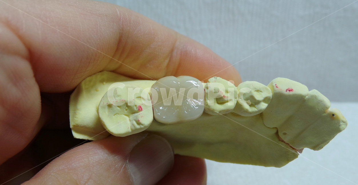 치과,보철,어금니,치과기공사,치아,teeth,보험,porcelain,dental,의료,의학,병원,medical,hospital,clinic